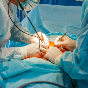 cirugia-de-abdomen
