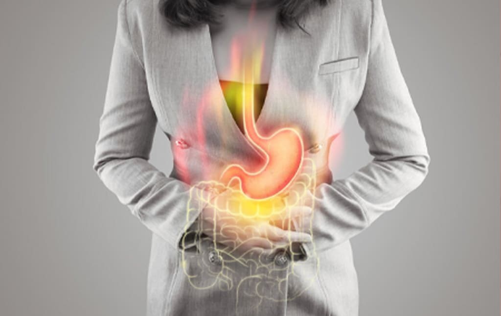 enfermedad-por-reflujo-gastroesofagico-cirugia-general-y-de-minima-invasion-en-puebla