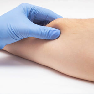 lipomas-y-tumores-de-tejidos-blando